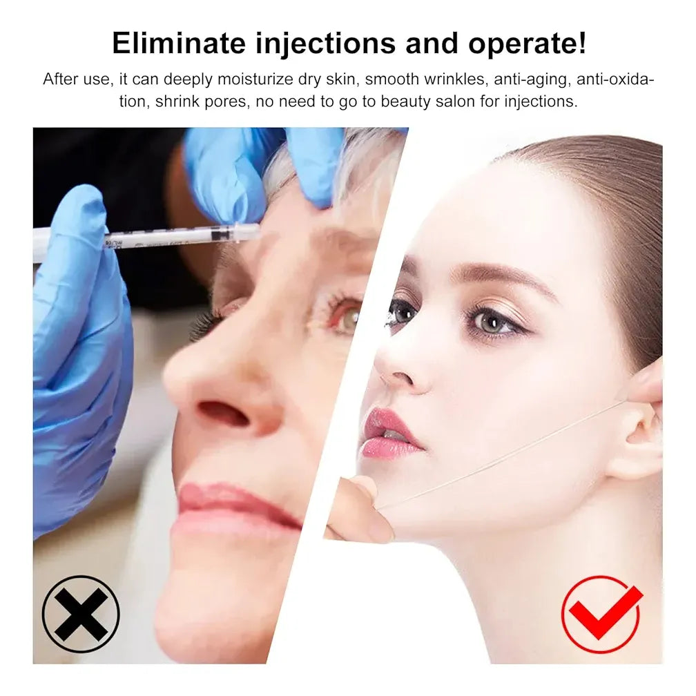 Hilos Tensores Faciales X20 Proteína Colageno Lifting